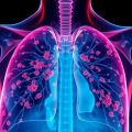 Pilzinfektionen (Aspergillose) en las vías respiratorias: cómo reconocerlas, entenderlas y actuar a tiempo